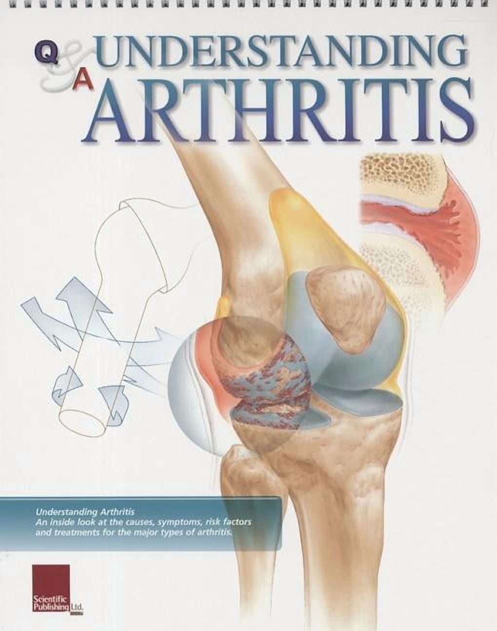 Understanding Arthritis Flip Chart (Other)
